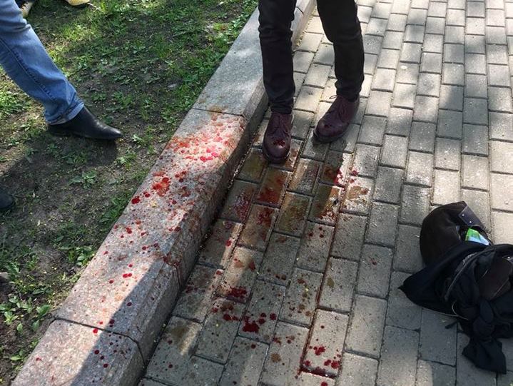 Во время акции 5 мая в Москве сломали нос мужчине, который сфотографировал "казака"