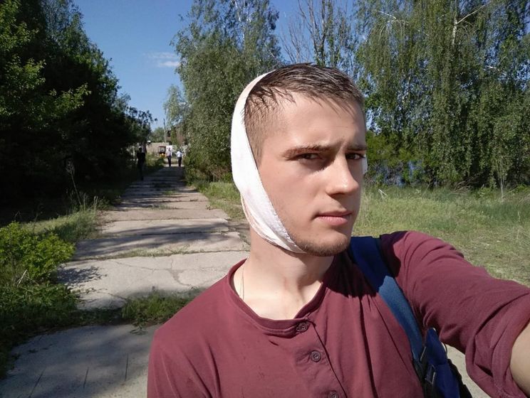 Журналіст заявив, що під час сутичок біля маєтку Льовочкіна поліцейський ударив його по голові