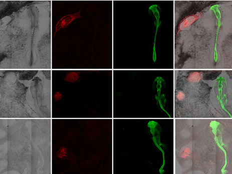 Ученые пересадили человеческие клетки в эмбрион курицы