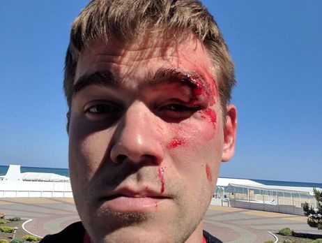 Маркетолог заявил, что его избил владелец интернет-магазина Stylus.ua из-за подозрений в продаже ворованного товара