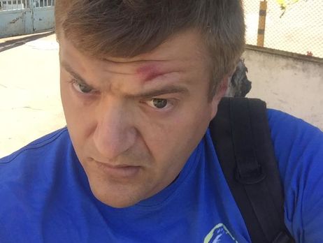 В Херсоне неизвестные избили журналиста Никитенко