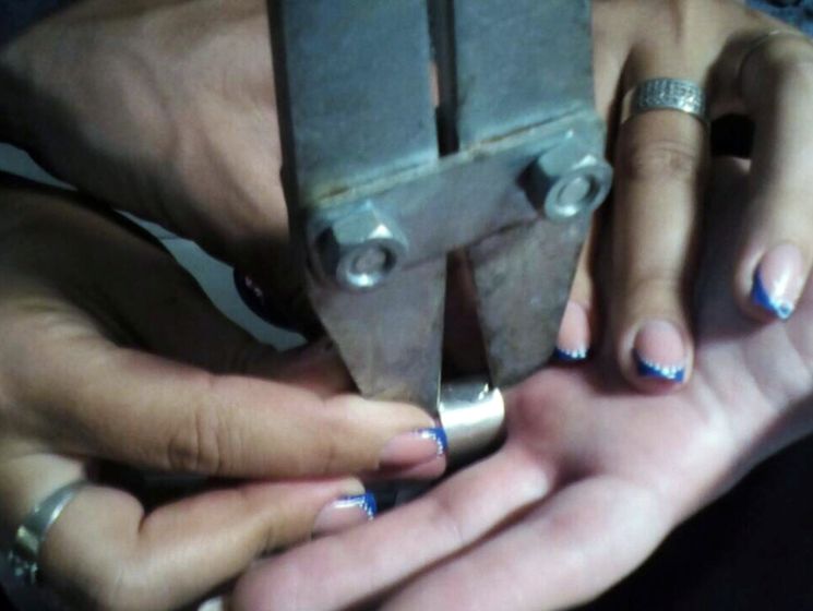 В Днепре женщина вызвала ГСЧС, чтобы снять кольцо с пальца