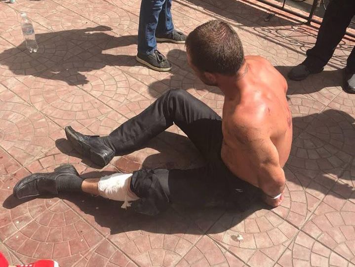 ﻿У Києві поліцейські прострелили ногу чоловікові, який кидався на патрульних із ножем