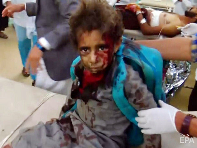 В Йемене ракета попала в автобус с детьми, погибли десятки человек
