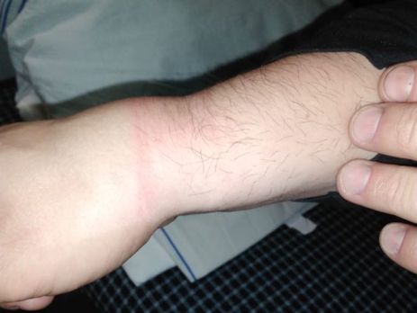 ﻿У Держприкордонслужбі України заявили, що російські прикордонники, ймовірно, побили українця