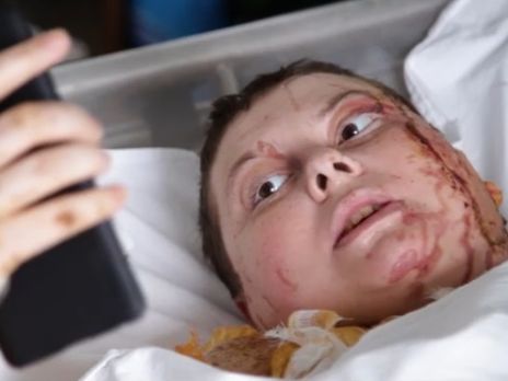 ﻿Гандзюк: Я знаю, що виглядаю погано. Але набагато краще, ніж виглядають зараз в Україні справедливість і правосуддя