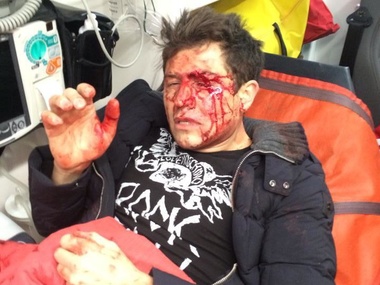 Украинский шоумен Джеджула госпитализирован после нападения неизвестных