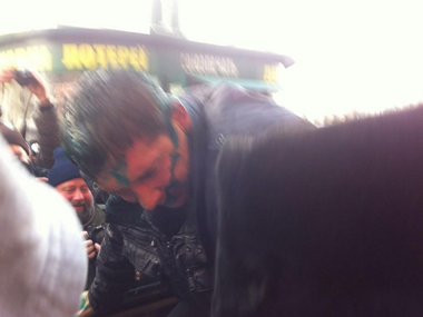Депутата горсовета Харькова облили зеленкой и бросили в мусорный бак