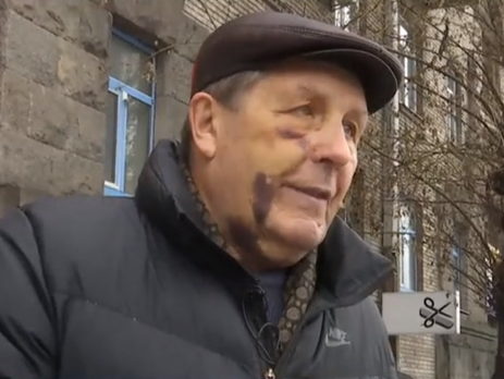 В Киеве избили авиаконструктора завода 