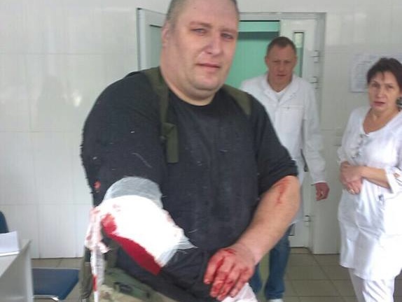 Аваков: Раненного после взрыва в Харькове комбата "Слобожанщины" и его жену прооперировали