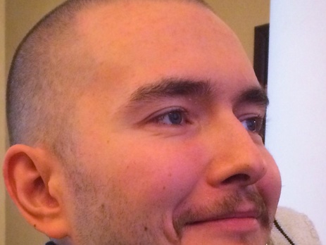 The Daily Mail: Российский программист согласился на трансплантацию своей головы на новое тело