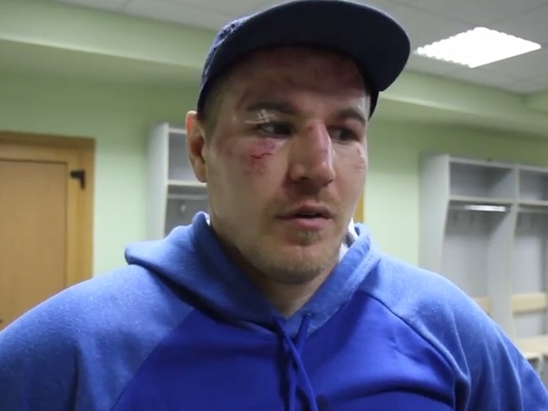 Проигравший Усику российский боксер Князев: Рефери зря остановил бой, там ничего такого не было. Видео