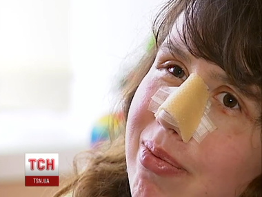 Генпрокуратура: Черновол избили за то, что она "подрезала" авто нападавших