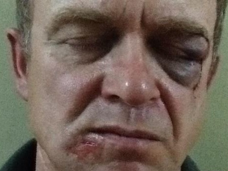 В Буче избили активиста, семья которого помогала 