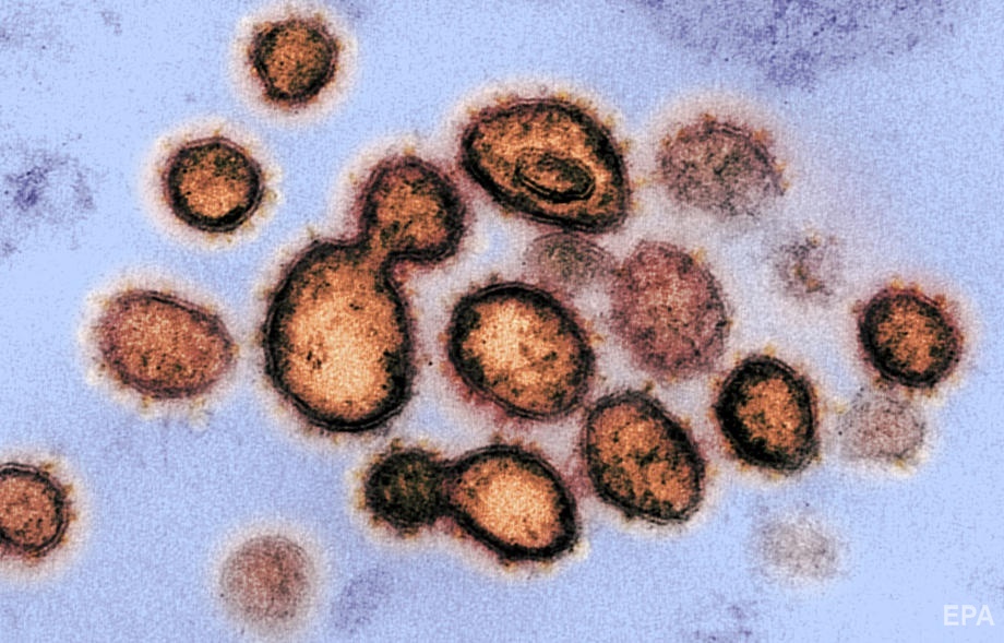 Коронавирус SARS-CoV-2 под микроскопом. Фото: EPA
